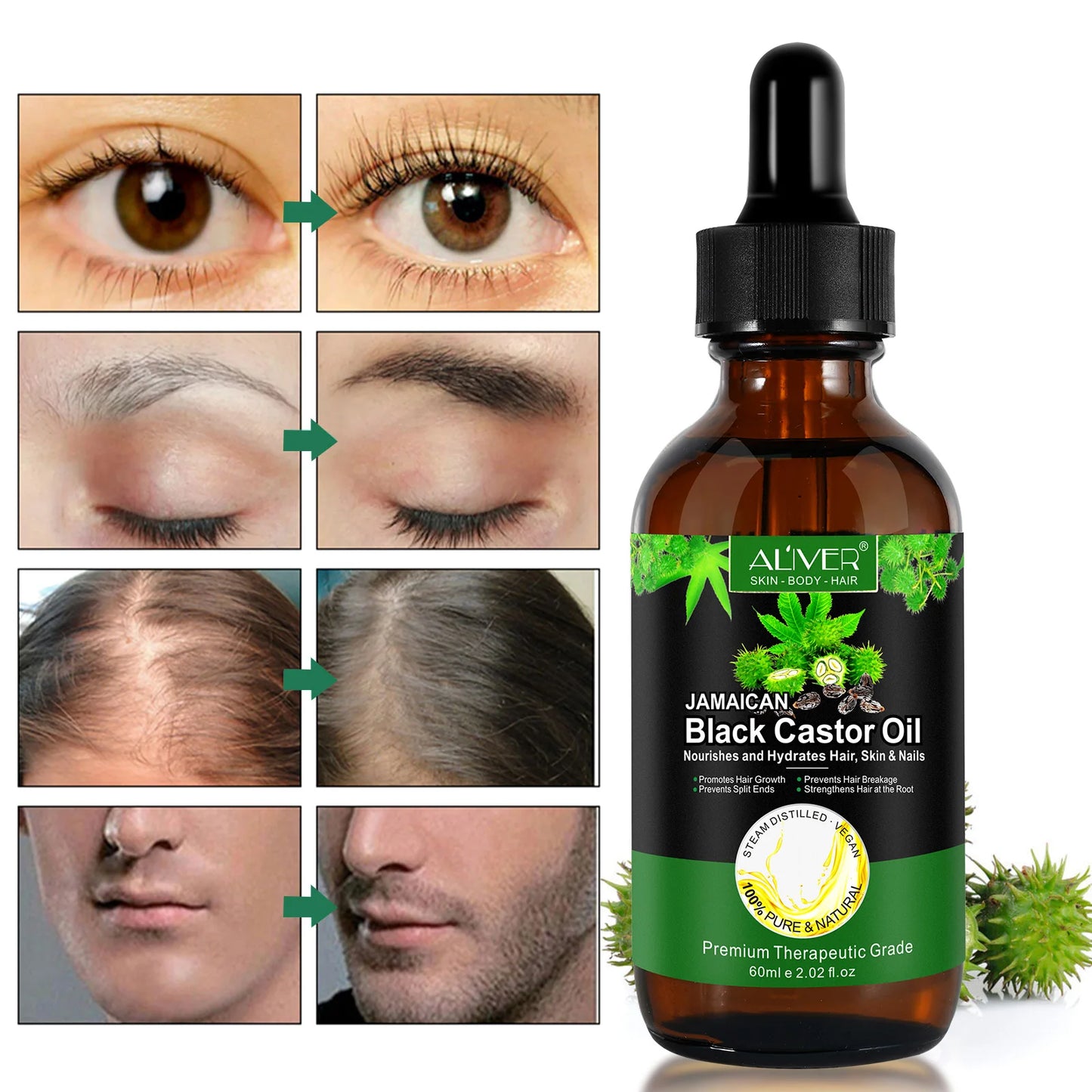 ALIVER 60Ml Pure Jamaican Black Castor Essential Oil Scalp Hair Strengthening Oil Infused Biotin and Encourages Growth Hair Oil