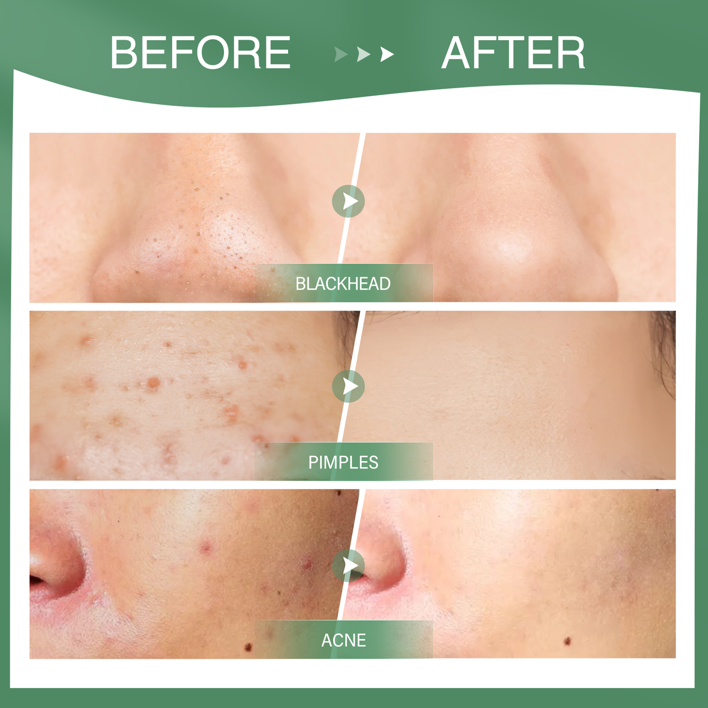 Own Brand Skin Repair and Acne Removing Organic Green Tea Facial Mask Mud Stick Customized Package Female Beauty Products 100pcs