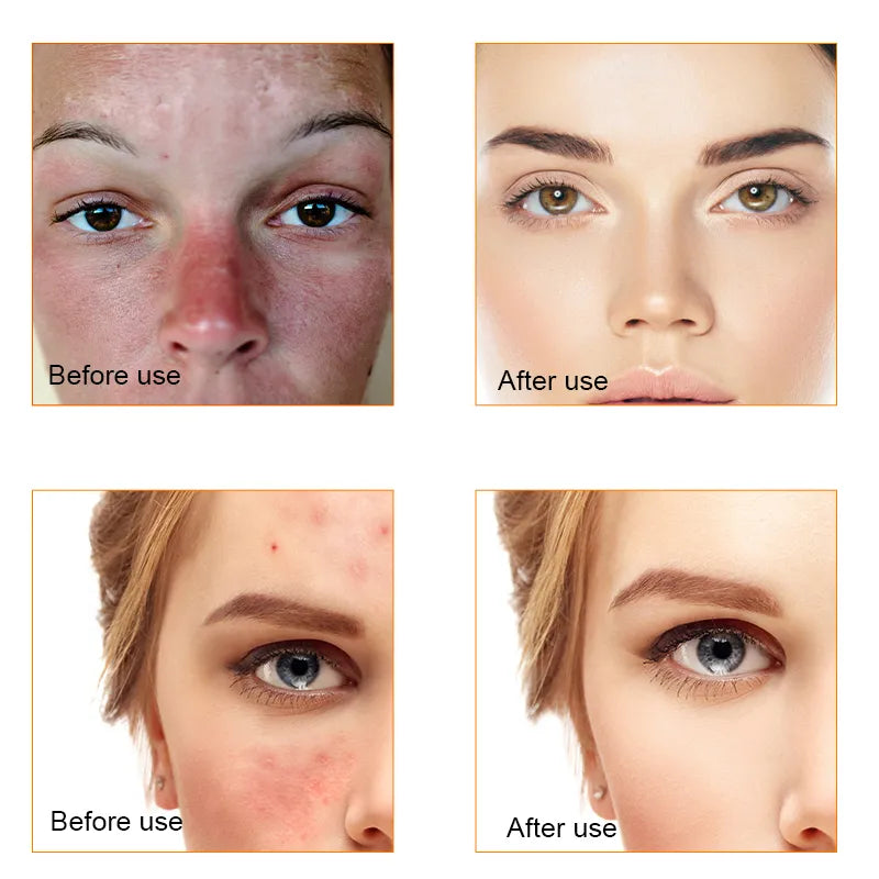Face Serum | Anti Wrinkle [Vitamin C]
